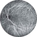 Angiografia Digital com Indocianina Verde